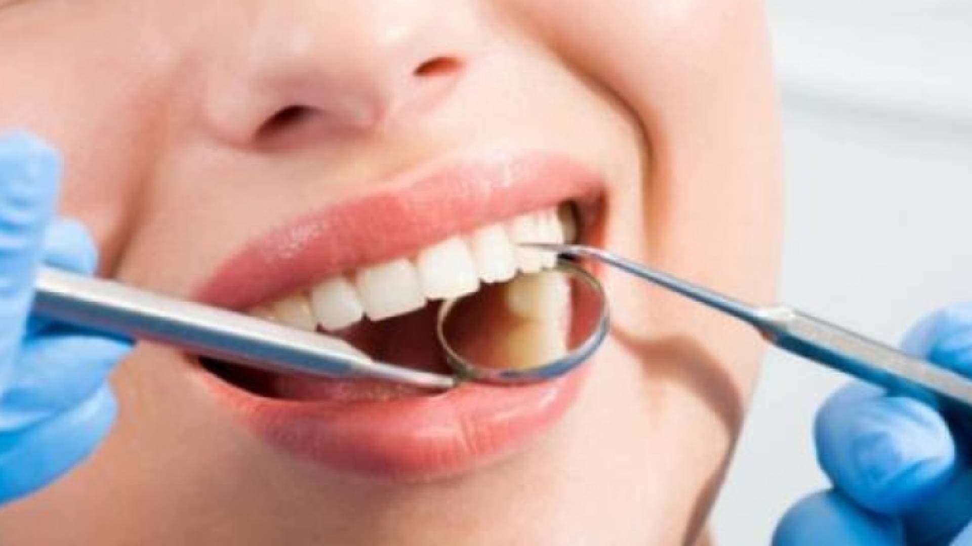 عادات خاطئة تدمر أسنانك.. تخلص منها