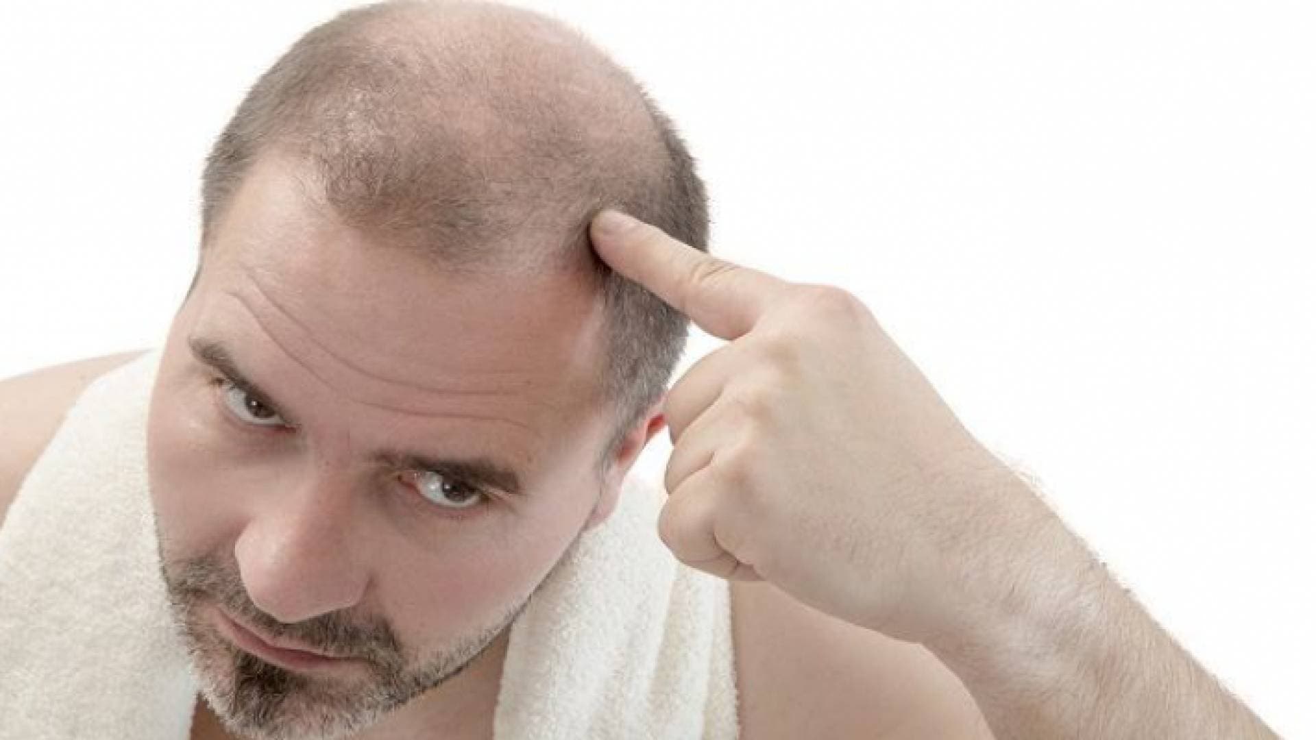هذه الأطعمة تسبب تساقط الشعر