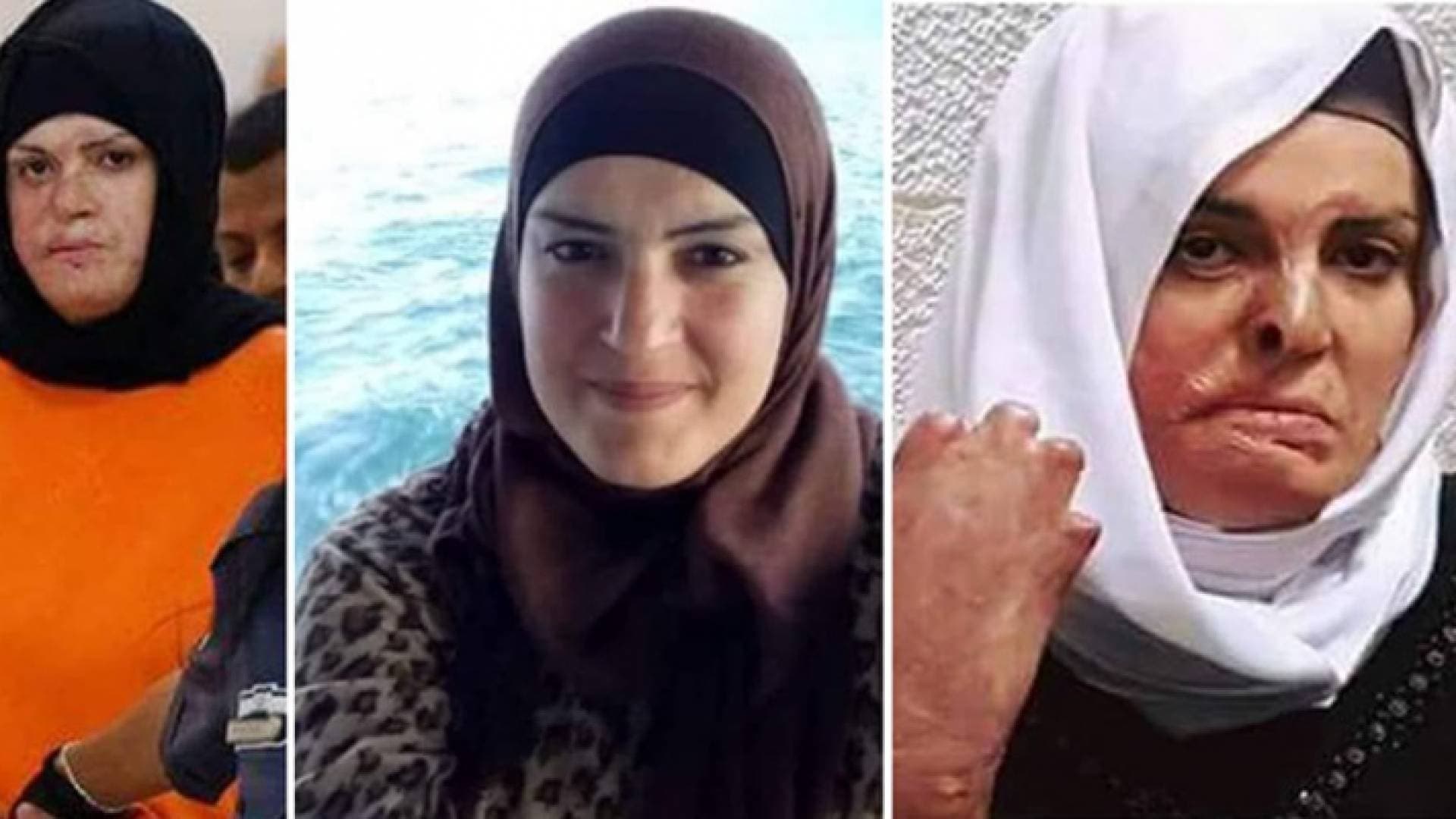 الأسيرة الفلسطينية إسراء جعابيص.. آلام الجسد وقهر السجان