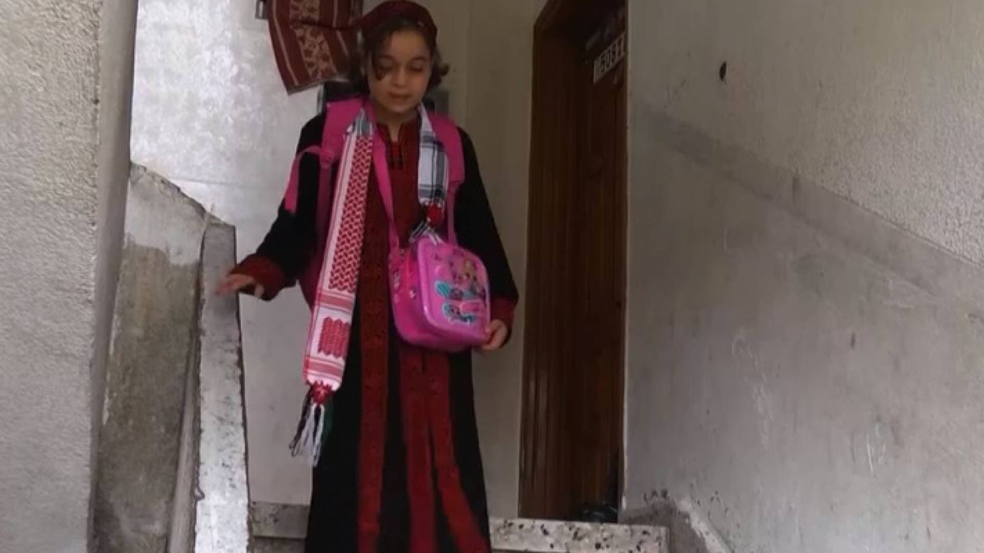 فرح.. طفلة غزية استعادت أملها في الحياة بعد رحلة علاج في الأردن - فيديو
