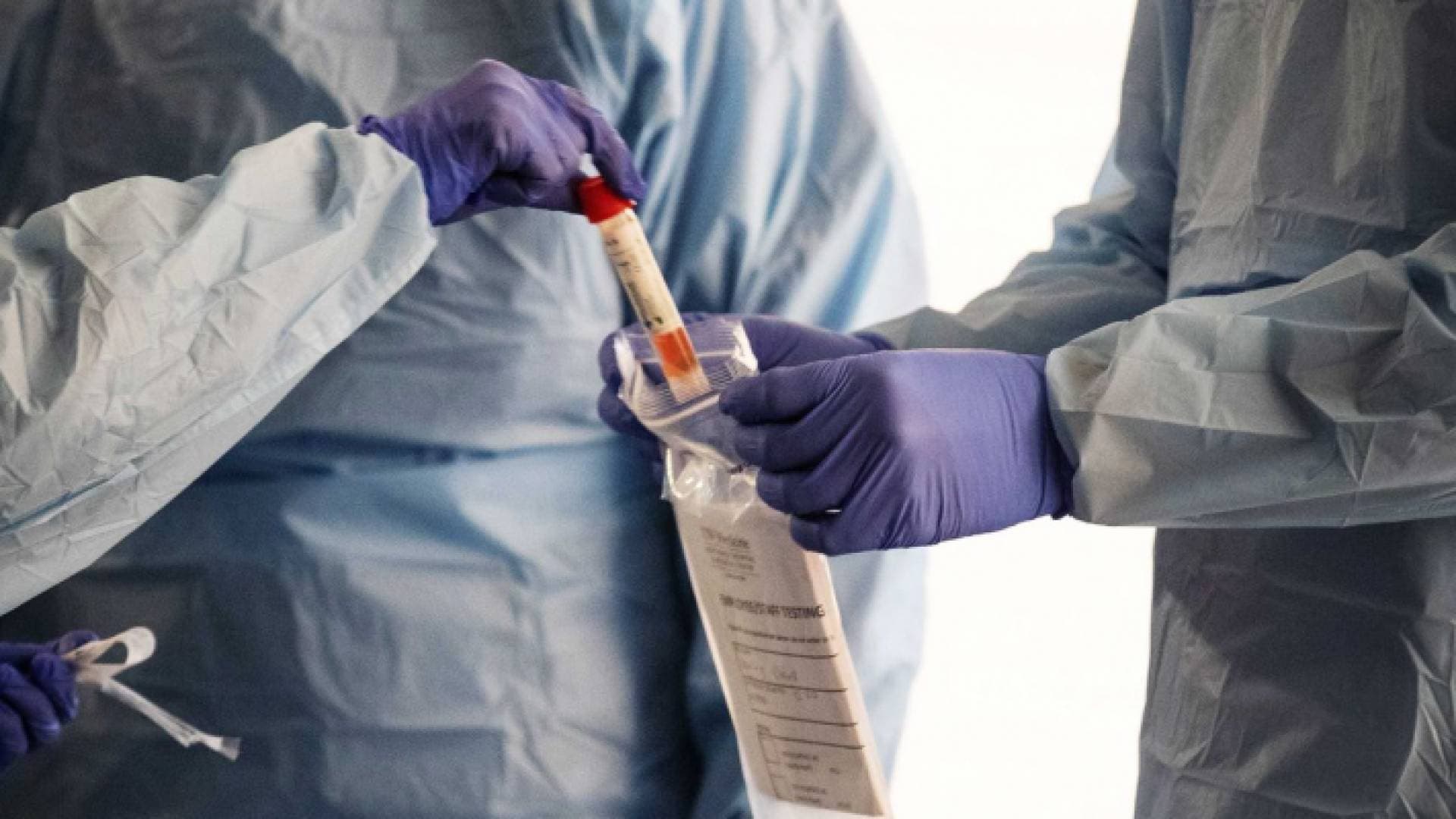قفزة في أعداد إصابات كورونا الثلاثاء بالأردن