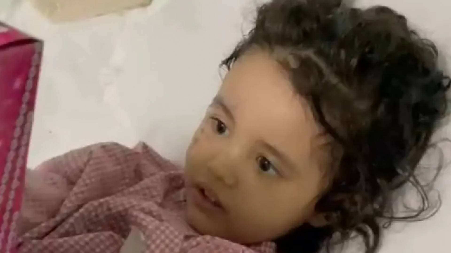 والد الطفلة ضحية الأسيد: طفلتي تعيش ظروفا صعبة