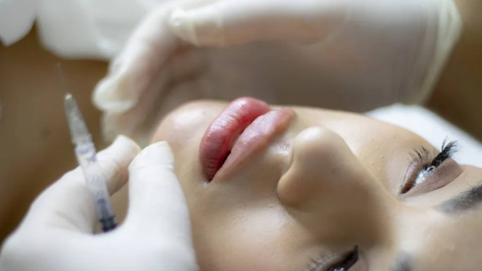 مادة جديدة لـ"الفيلر".. مزايا مذهلة لكنها لا تدوم