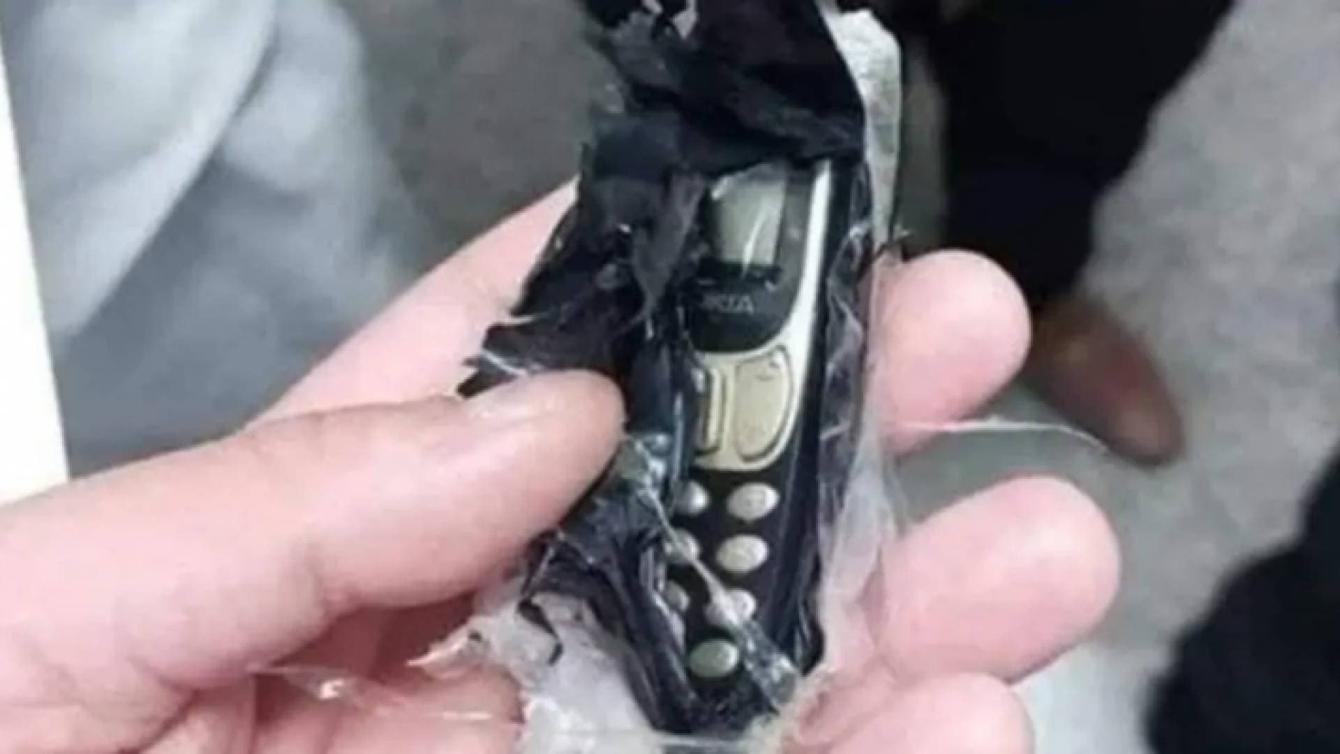 حادث غريب.. استخراج هاتف محمول من بطن شاب في مصر