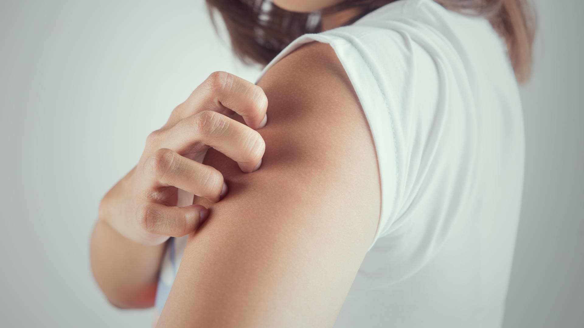 "التوتر والقلق".. إليك أسباب الحكة وطرق العلاج