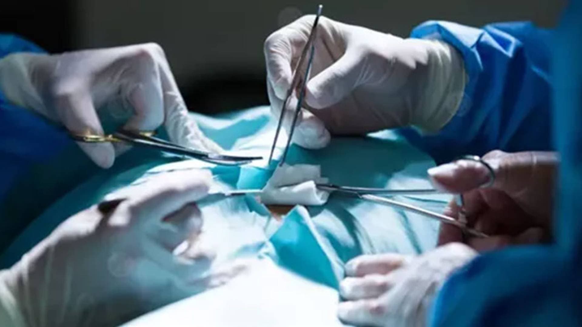 لأول مرة في مصر.. نجاح جراحة نادرة بالمنظار الصدري لرضيع