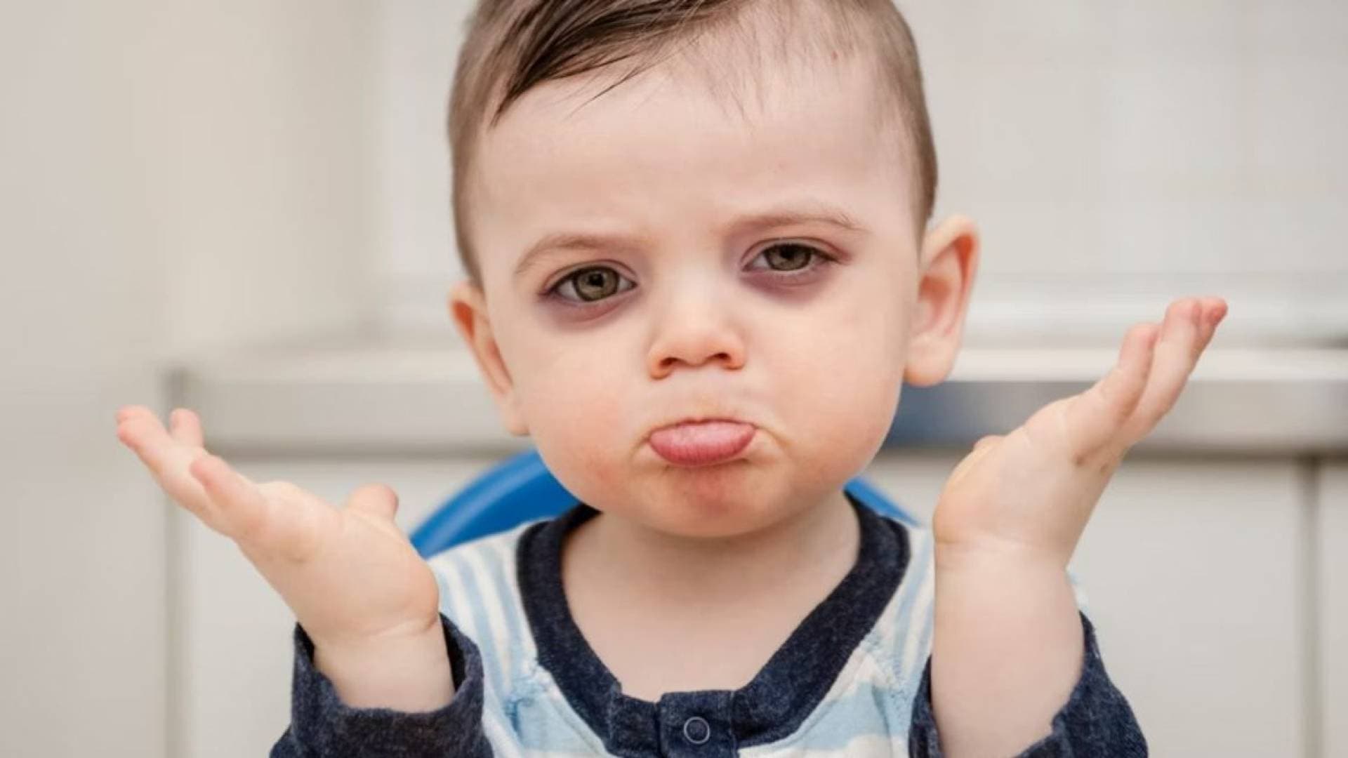 ما دلالة الهالات السوداء تحت عيون الأطفال؟